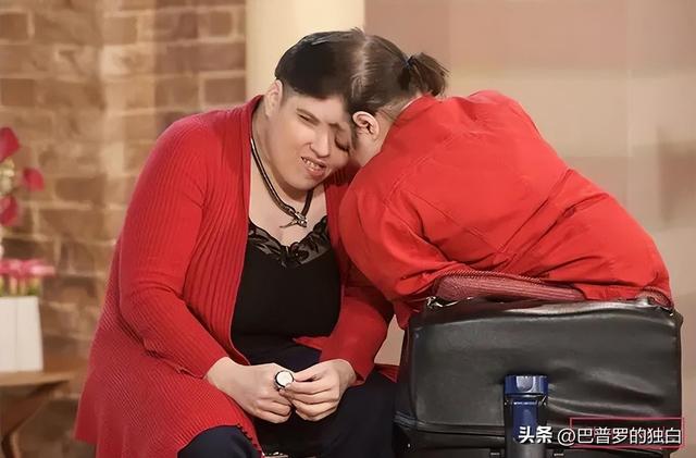 世界最长寿连体女婴去世，一生从未见面，却相伴生活62年