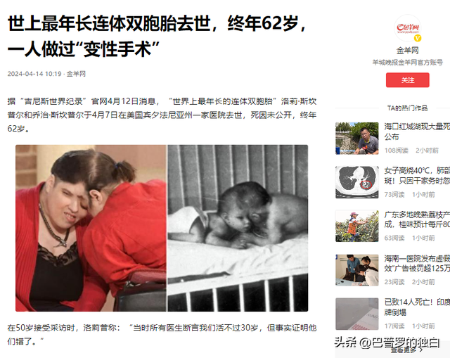世界最长寿连体女婴去世，一生从未见面，却相伴生活62年