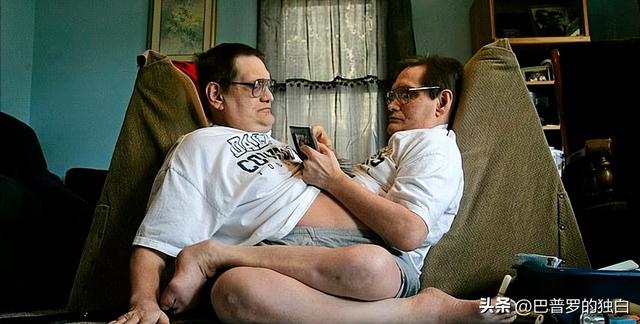 世界最长寿连体女婴去世，一生从未见面，却相伴生活62年