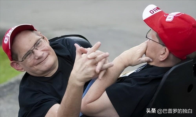 世界最长寿连体女婴去世，一生从未见面，却相伴生活62年